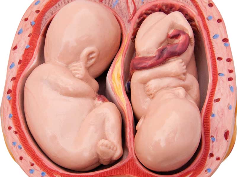 gemelli utero